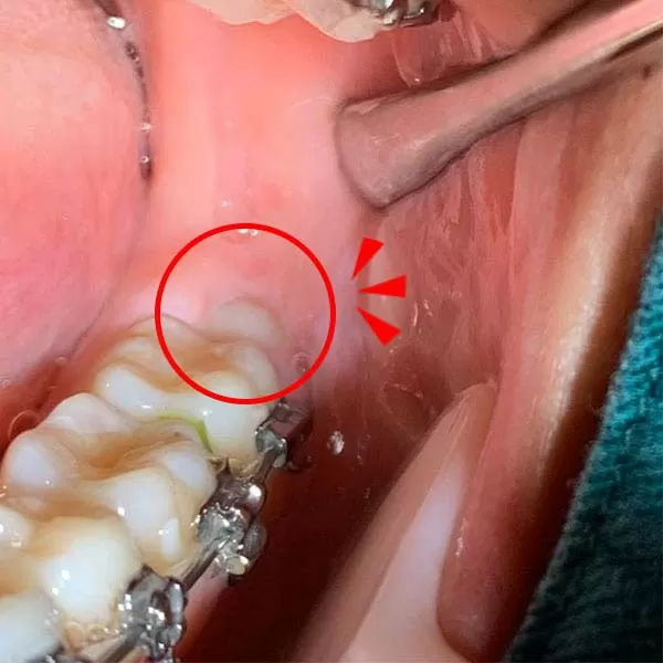 口腔外科 口腔外科