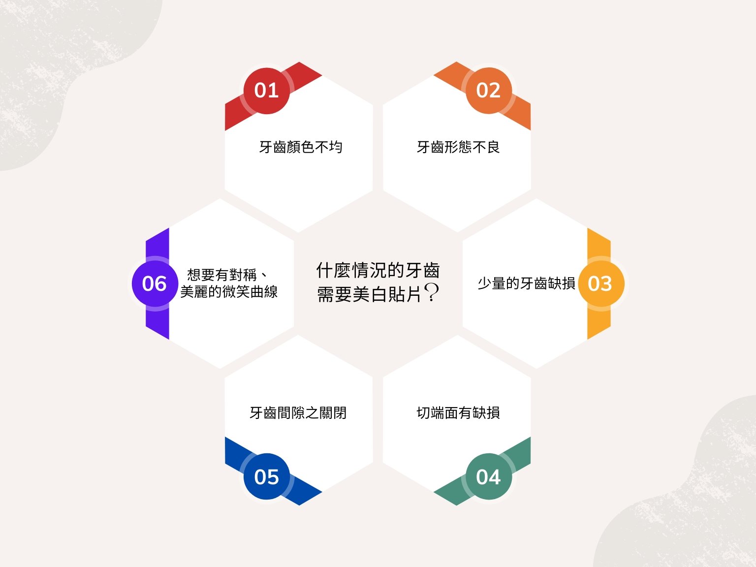 美齒貼片 美齒貼片