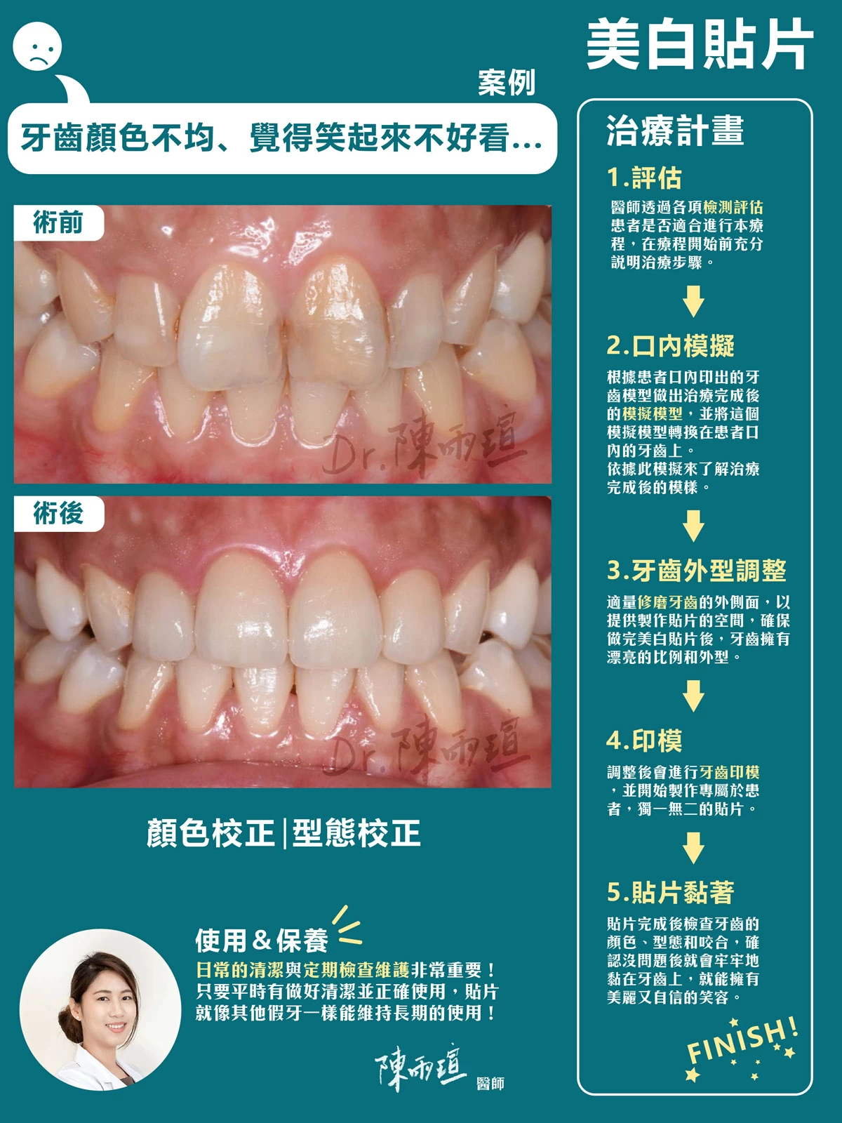 陳雨瑄 | 牙體復形專科