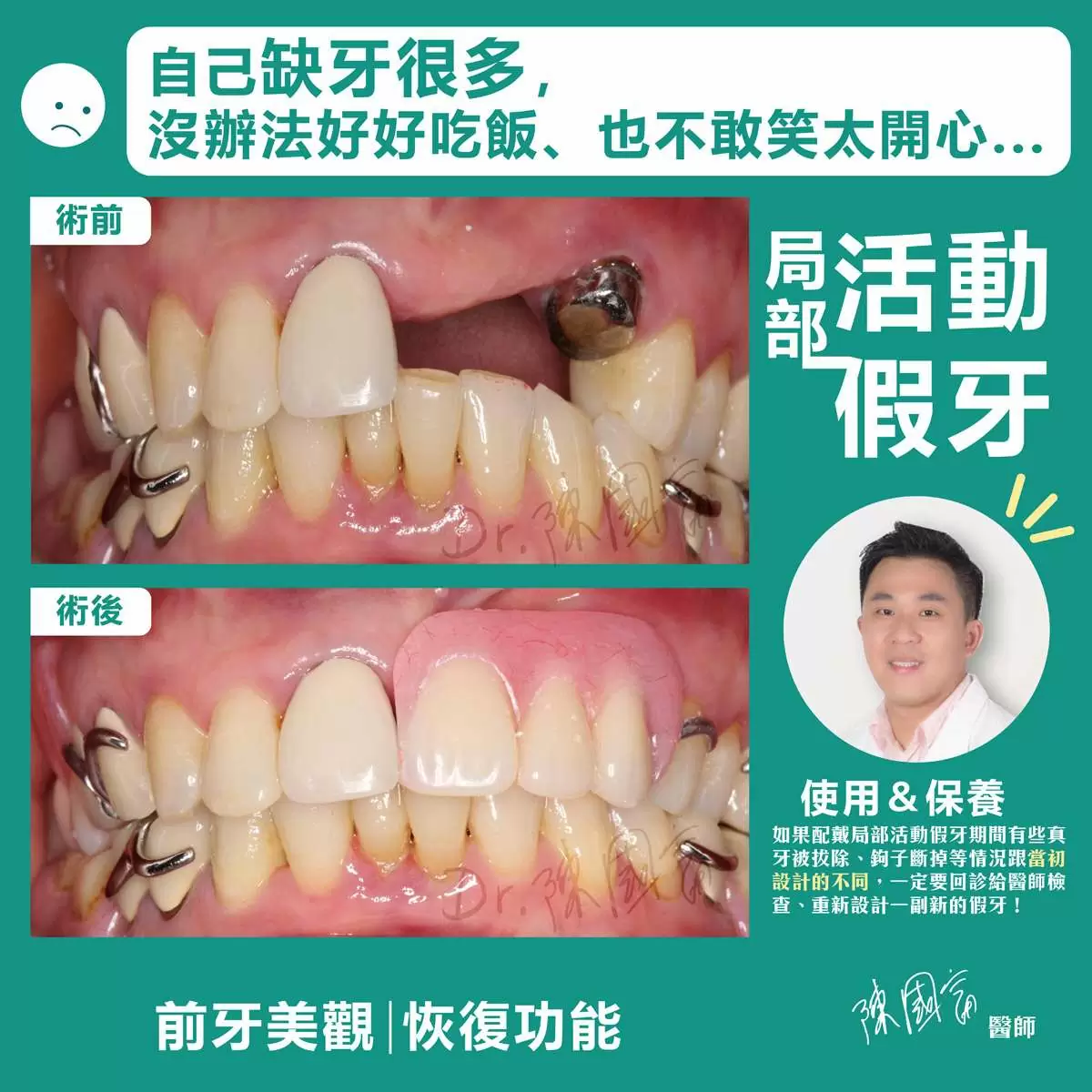 陳國富 | 活動假牙專家