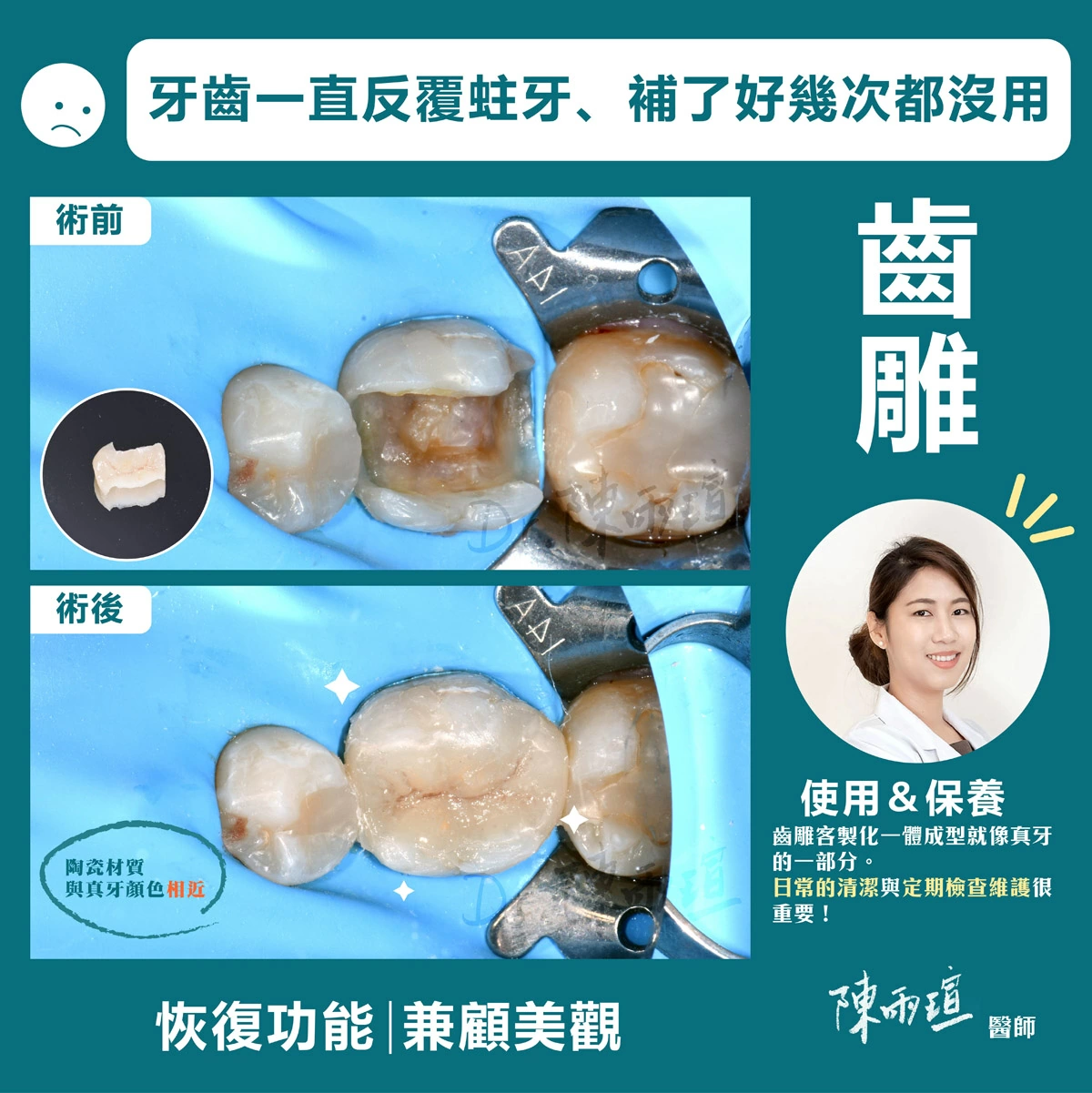 陳雨瑄 | 牙體復形專科