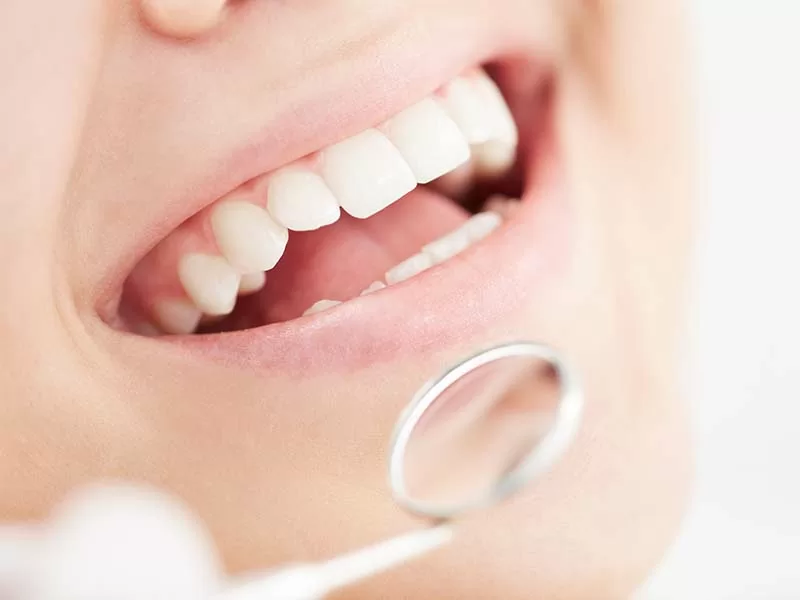 牙周反覆復發 牙周反覆復發