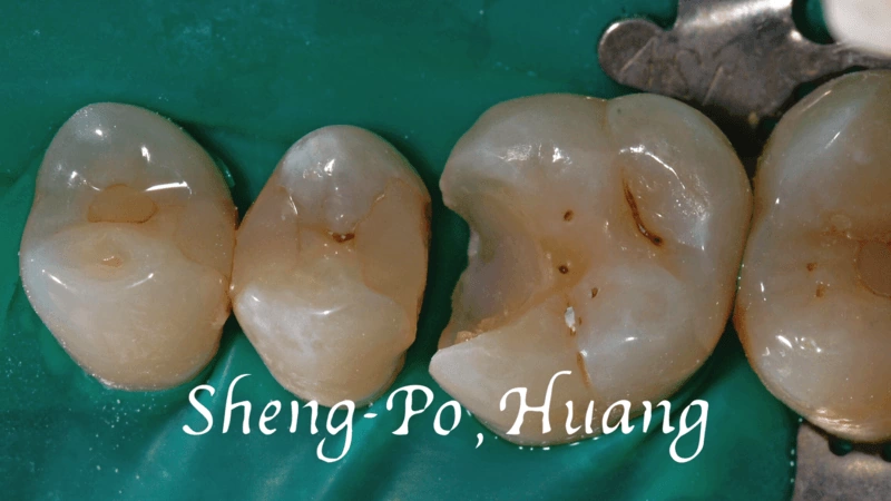 黃聖博｜牙齒美學專家