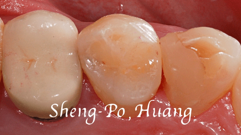 黃聖博｜牙齒美學專家