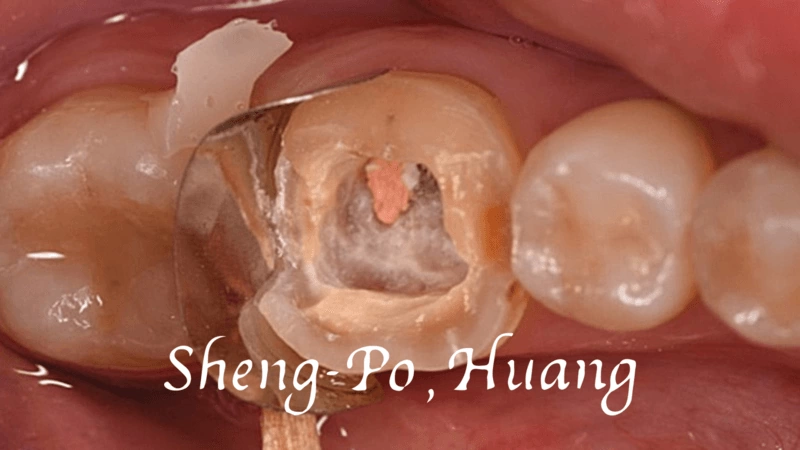 黃聖博｜牙齒美學專家