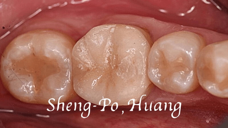 黃聖博｜牙齒美學專家