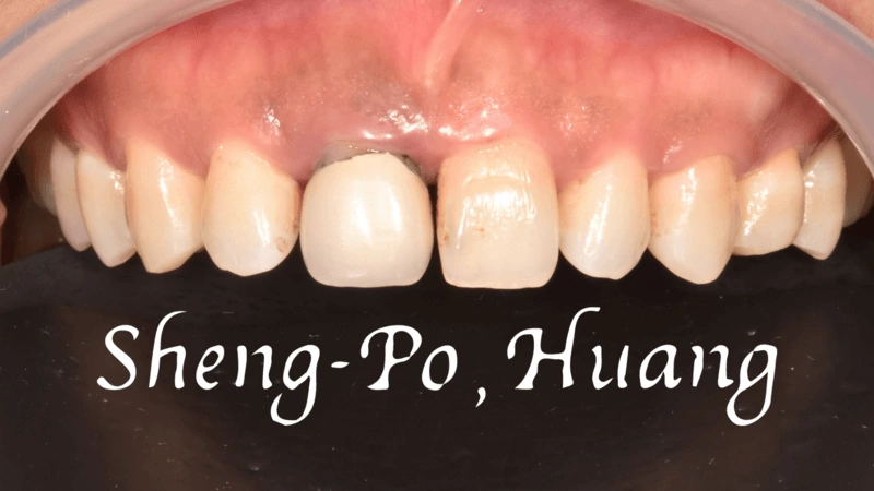 黃聖博｜牙齒美學專家