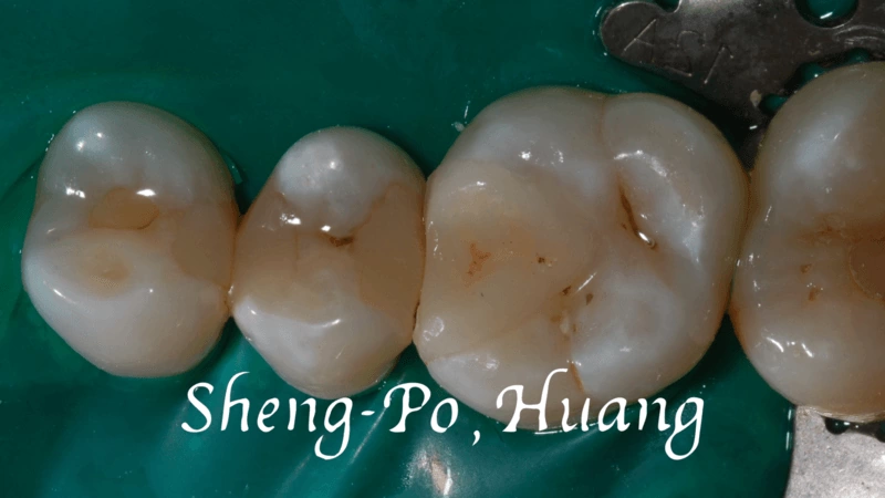 黃聖博｜牙齒美學專家