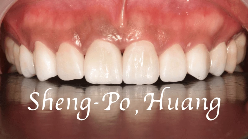 黃聖博｜牙齒美學專家