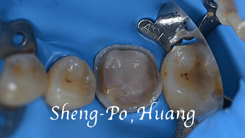 黃聖博｜牙齒美學專家