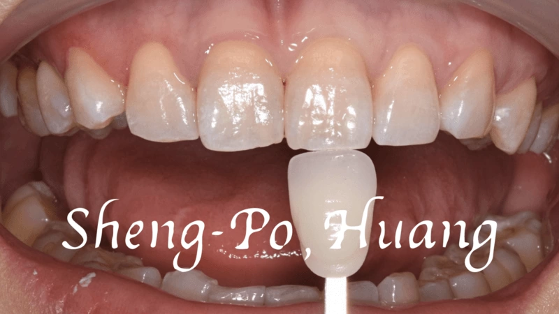 黃聖博｜牙齒美學專家