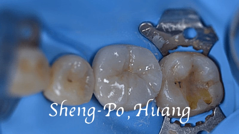 黃聖博｜牙齒美學專家