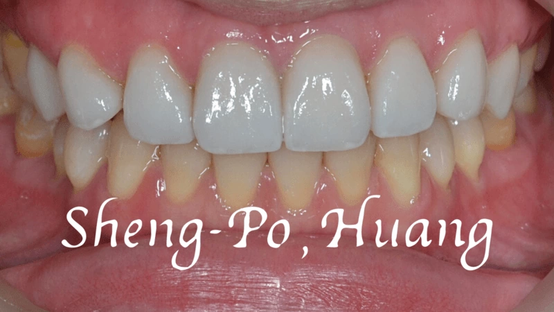 黃聖博｜牙齒美學專家