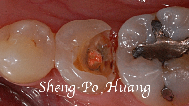 黃聖博｜牙齒美學專家