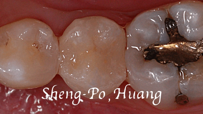 黃聖博｜牙齒美學專家