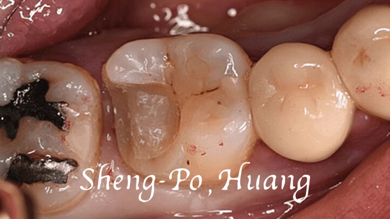 黃聖博｜牙齒美學專家