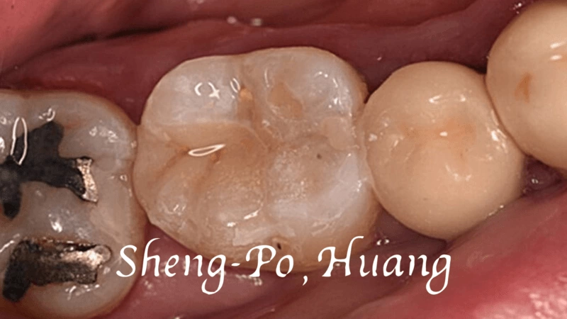 黃聖博｜牙齒美學專家