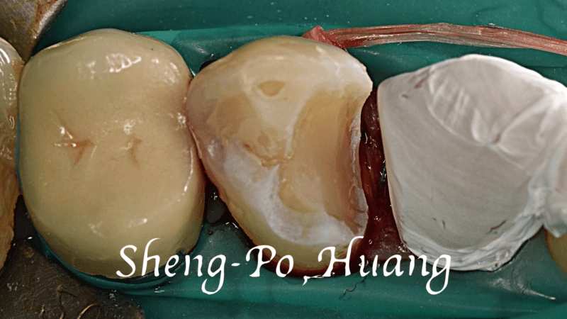 黃聖博｜牙齒美學專家