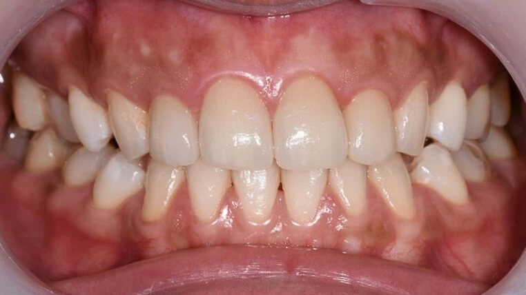 陳雨瑄 | 牙體復形專科