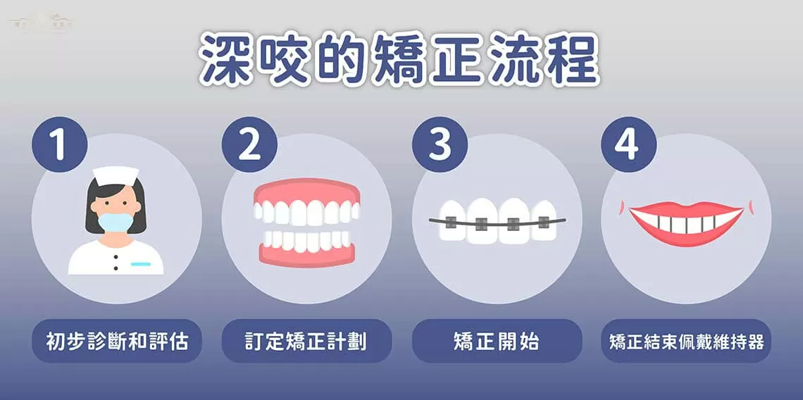 矯正深咬問題:方法與預期效果 矯正深咬問題:方法與預期效果