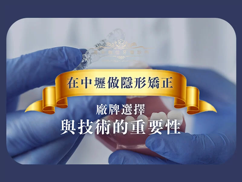 在中壢做隱形矯正：廠牌選擇與技術的重要性