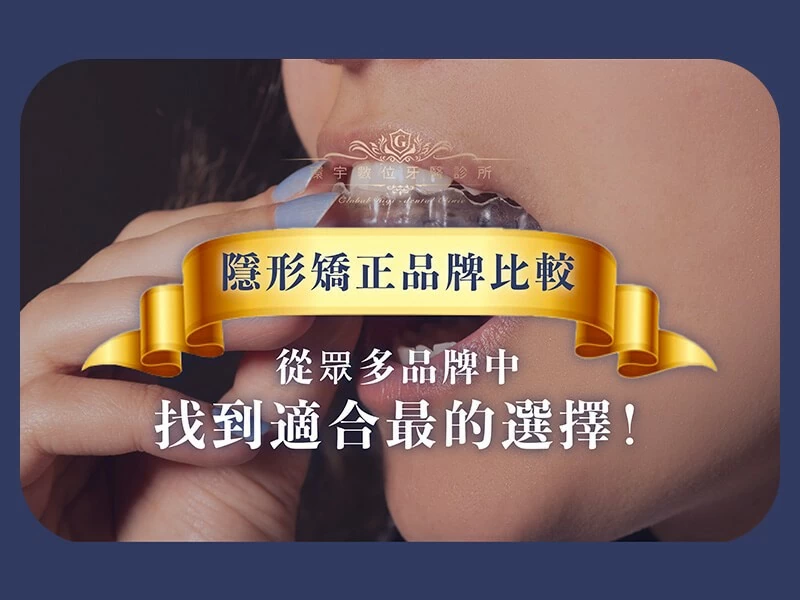 隱形矯正品牌比較：找到適合你的選擇