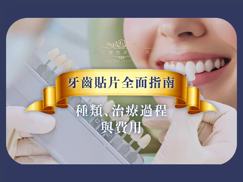 牙齒貼片全面指南：種類、治療過程與費用
