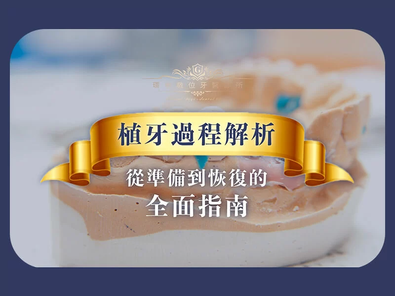 植牙過程解析：從準備到恢復的全面指南
