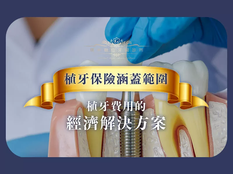 植牙保險涵蓋範圍：植牙費用的經濟解決方案