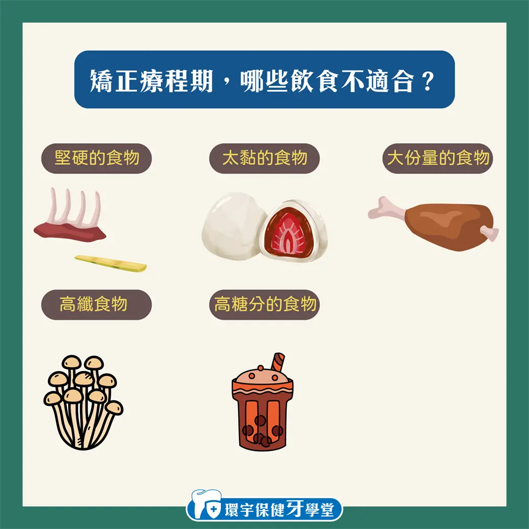 矯正牙齒初期飲食指南:輕鬆矯正也能吃得健康 矯正牙齒初期飲食指南:輕鬆矯正也能吃得健康