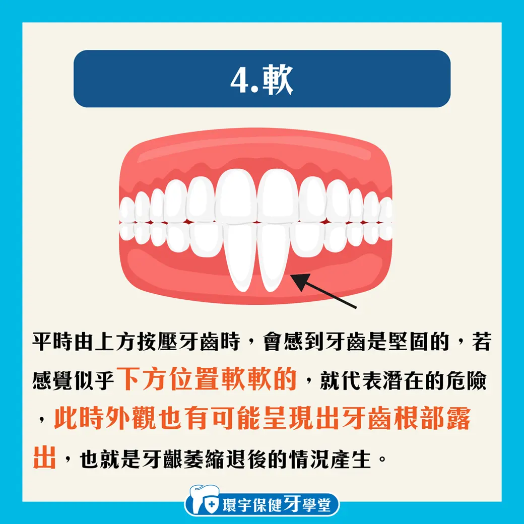 牙齦腫腫的是牙周病嗎?教您如何自我檢測! 牙齦腫腫的是牙周病嗎?教您如何自我檢測!