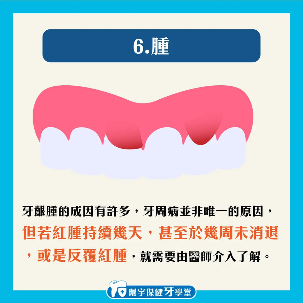 牙齦腫腫的是牙周病嗎?教您如何自我檢測! 牙齦腫腫的是牙周病嗎?教您如何自我檢測!
