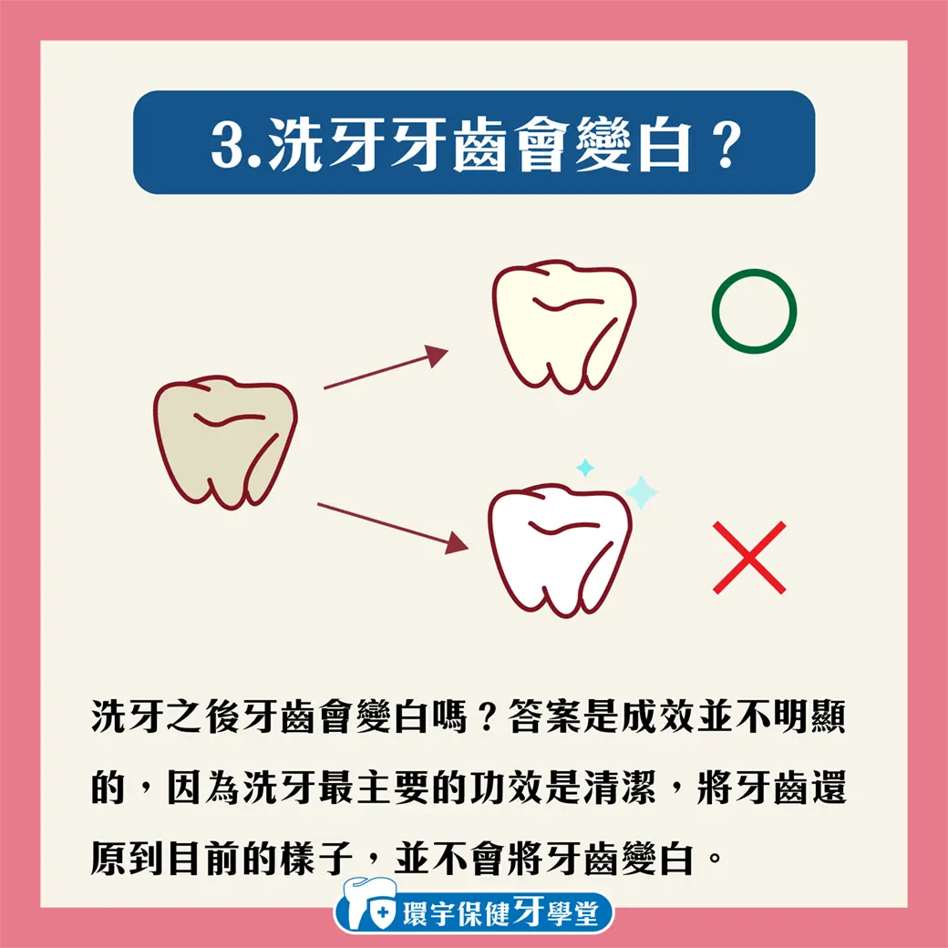 環宇保健牙學堂 - 洗牙會傷牙?洗牙有甚麼要注意的? 環宇保健牙學堂 - 洗牙會傷牙?洗牙有甚麼要注意的?