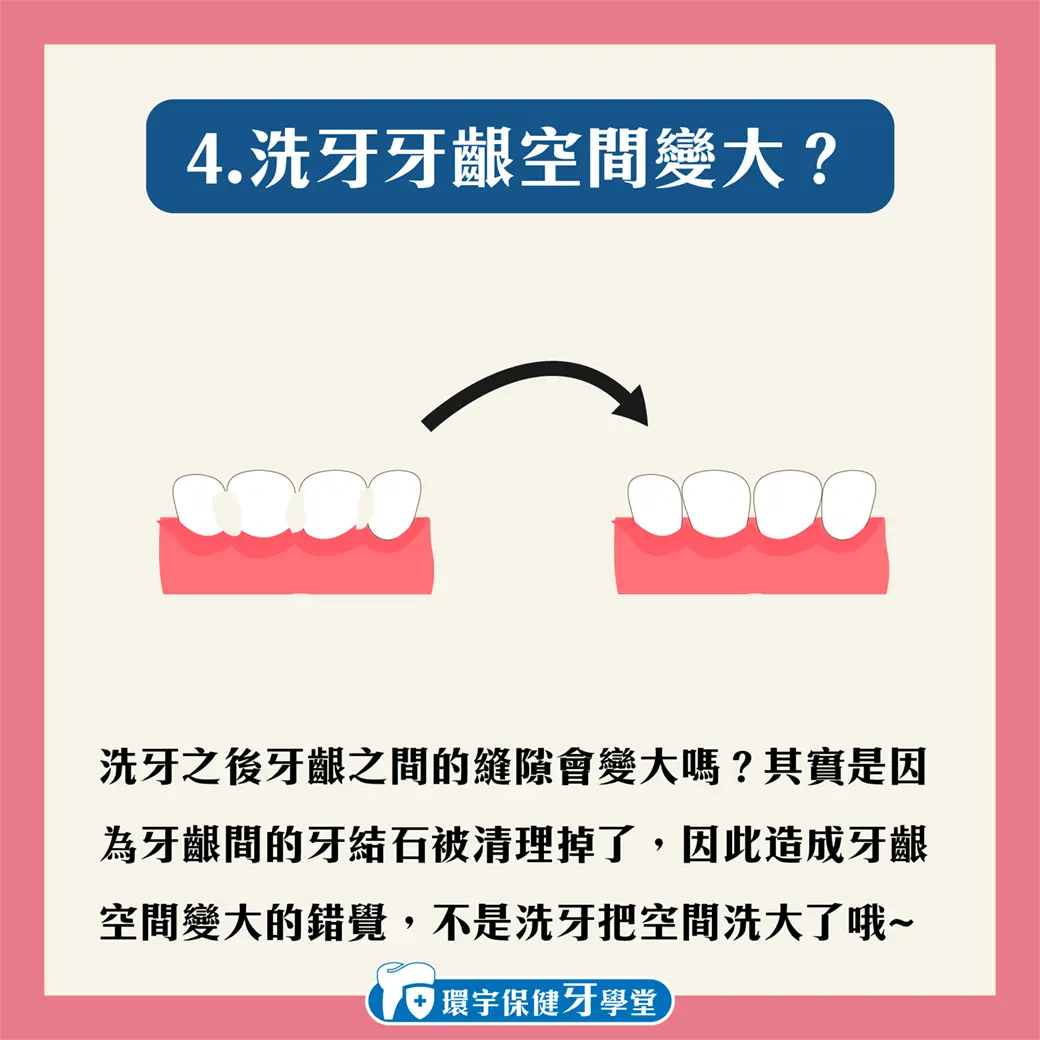 環宇保健牙學堂 - 洗牙會傷牙?洗牙有甚麼要注意的? 環宇保健牙學堂 - 洗牙會傷牙?洗牙有甚麼要注意的?
