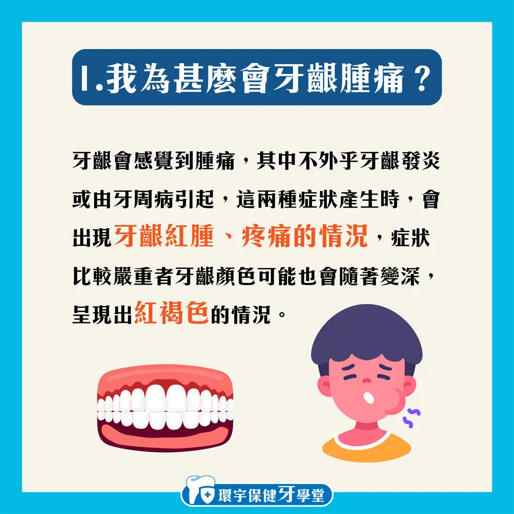 從飲食到日常護理:全方位防止牙齦腫痛 從飲食到日常護理:全方位防止牙齦腫痛