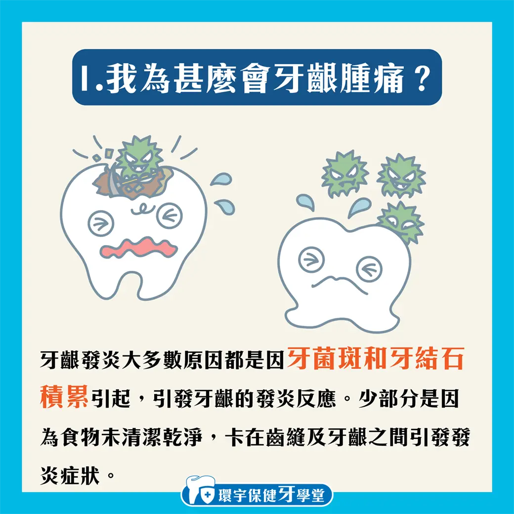 從飲食到日常護理:全方位防止牙齦腫痛 從飲食到日常護理:全方位防止牙齦腫痛