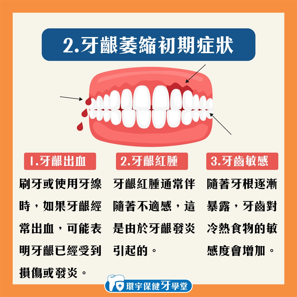 治療牙齦萎縮:手術與非手術選擇的詳細解析 治療牙齦萎縮:手術與非手術選擇的詳細解析