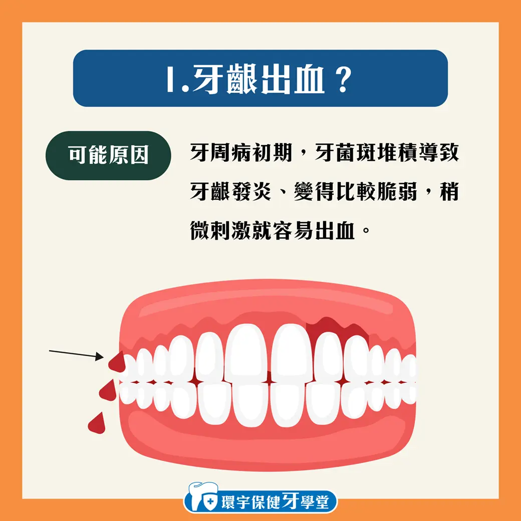 牙齦越來越短?牙齦萎縮的五大警訊! 牙齦越來越短?牙齦萎縮的五大警訊!