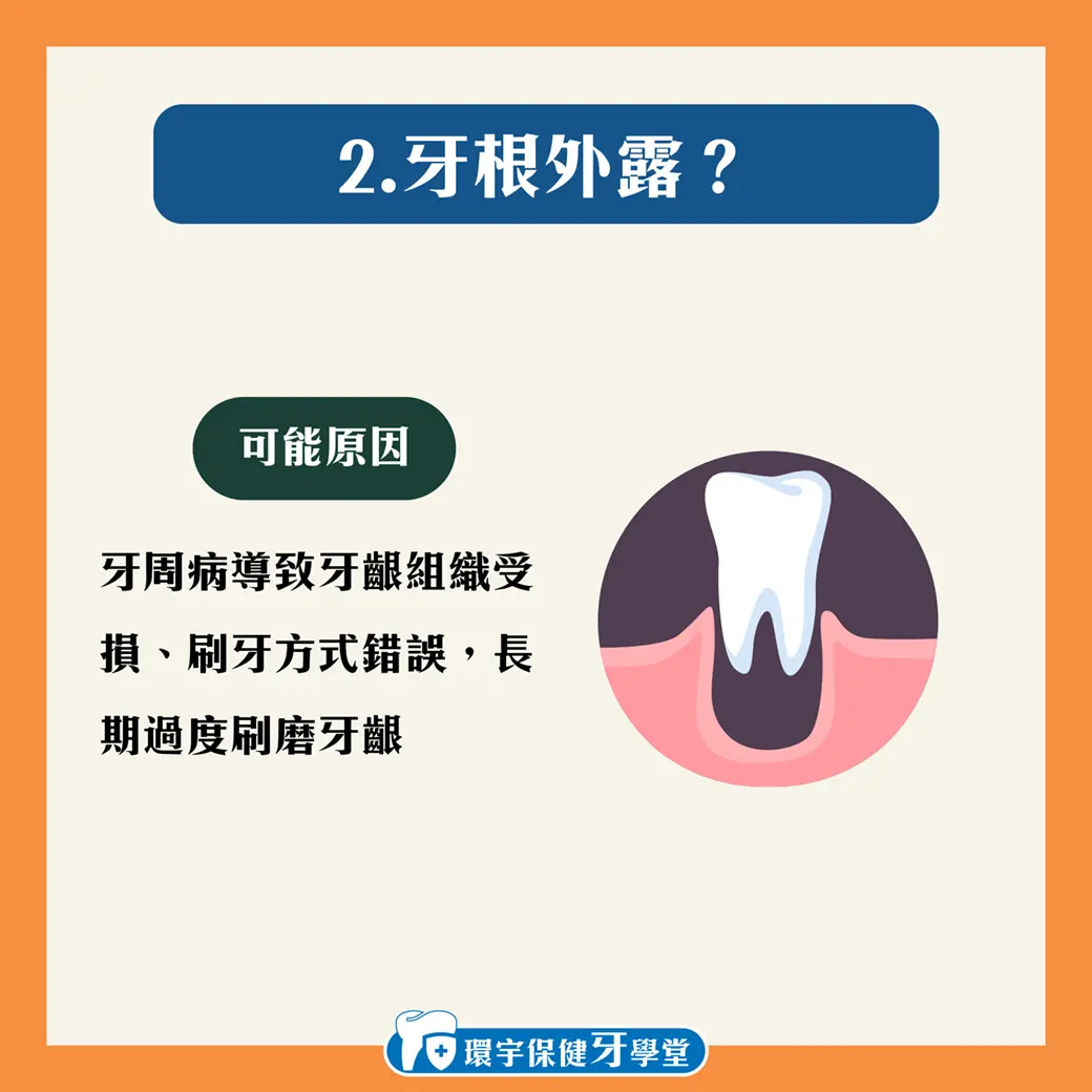 牙齦越來越短?牙齦萎縮的五大警訊! 牙齦越來越短?牙齦萎縮的五大警訊!