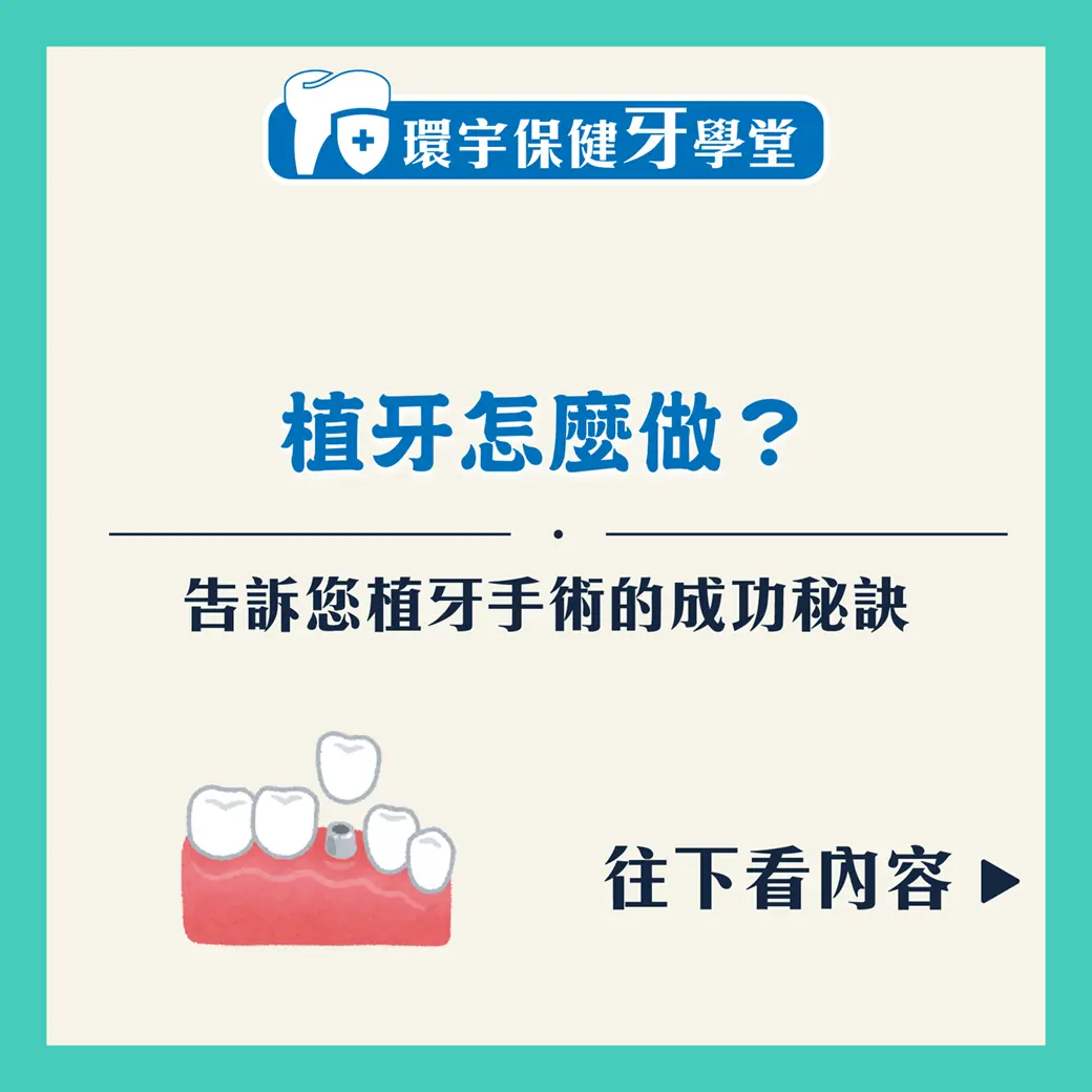 揭開植牙成功與失敗的秘密：流程與因素詳解
