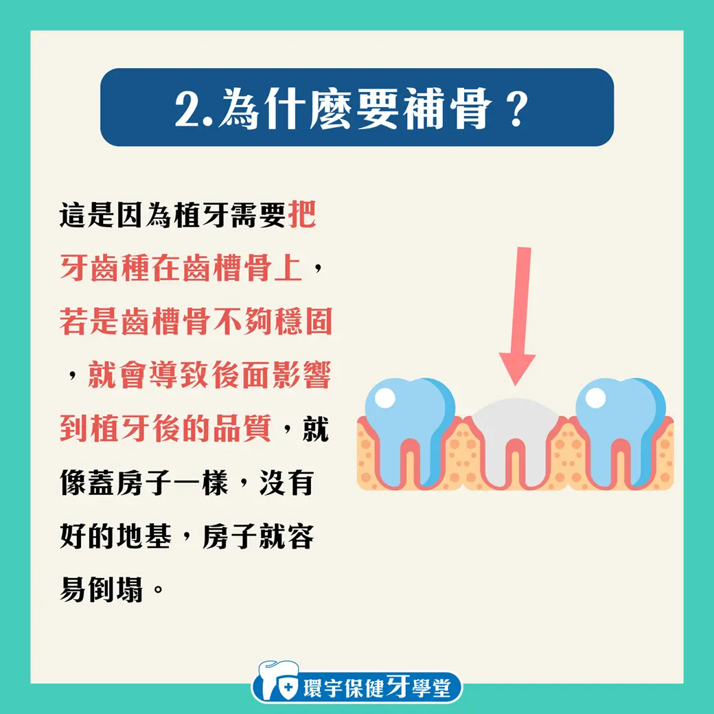 揭開植牙成功與失敗的秘密:流程與因素詳解 揭開植牙成功與失敗的秘密:流程與因素詳解