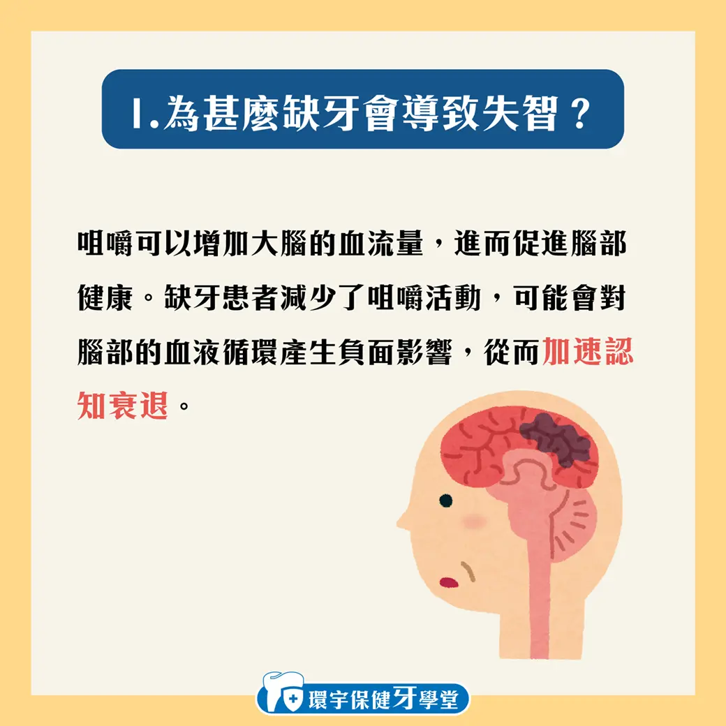 缺牙對健康的影響:從失智到其他身體問題 缺牙對健康的影響:從失智到其他身體問題