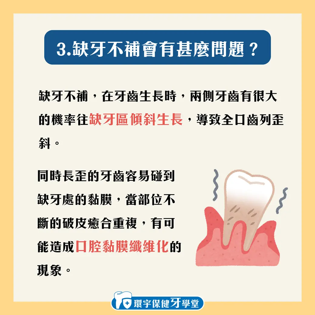 缺牙對健康的影響:從失智到其他身體問題 缺牙對健康的影響:從失智到其他身體問題