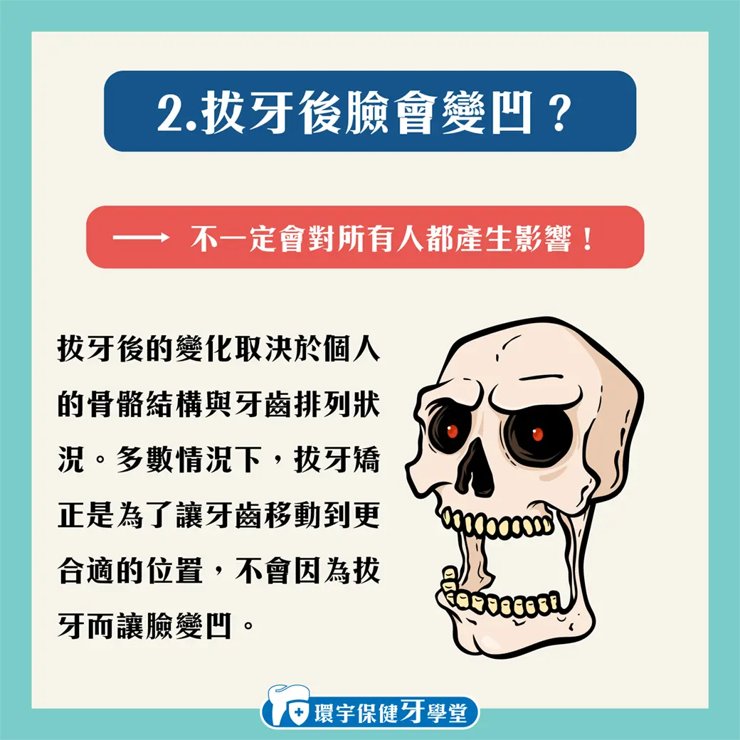牙齒矯正前需要拔牙嗎?常見誤解一次解答 牙齒矯正前需要拔牙嗎?常見誤解一次解答