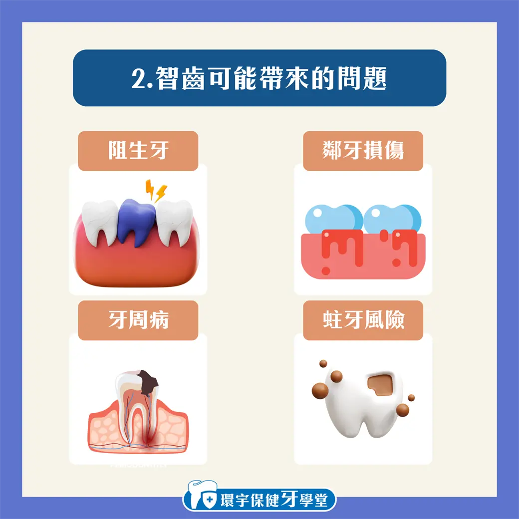 智齒拔或不拔?告訴您決定的小技巧 智齒拔或不拔?告訴您決定的小技巧