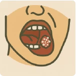 口腔黏膜病灶 病毒感染