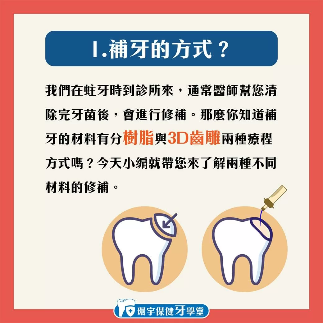 環宇保健牙學堂 - 3D齒雕與樹脂補牙差在哪裡？