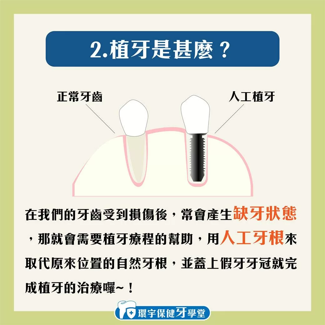 環宇保健牙學堂 - 植牙與假牙