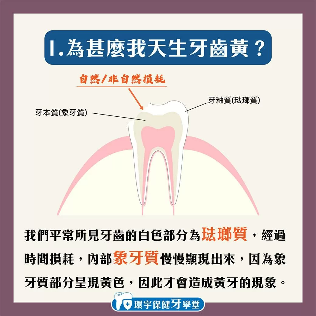 環宇保健牙學堂 - 為甚麼我的牙齒黃黃的？
