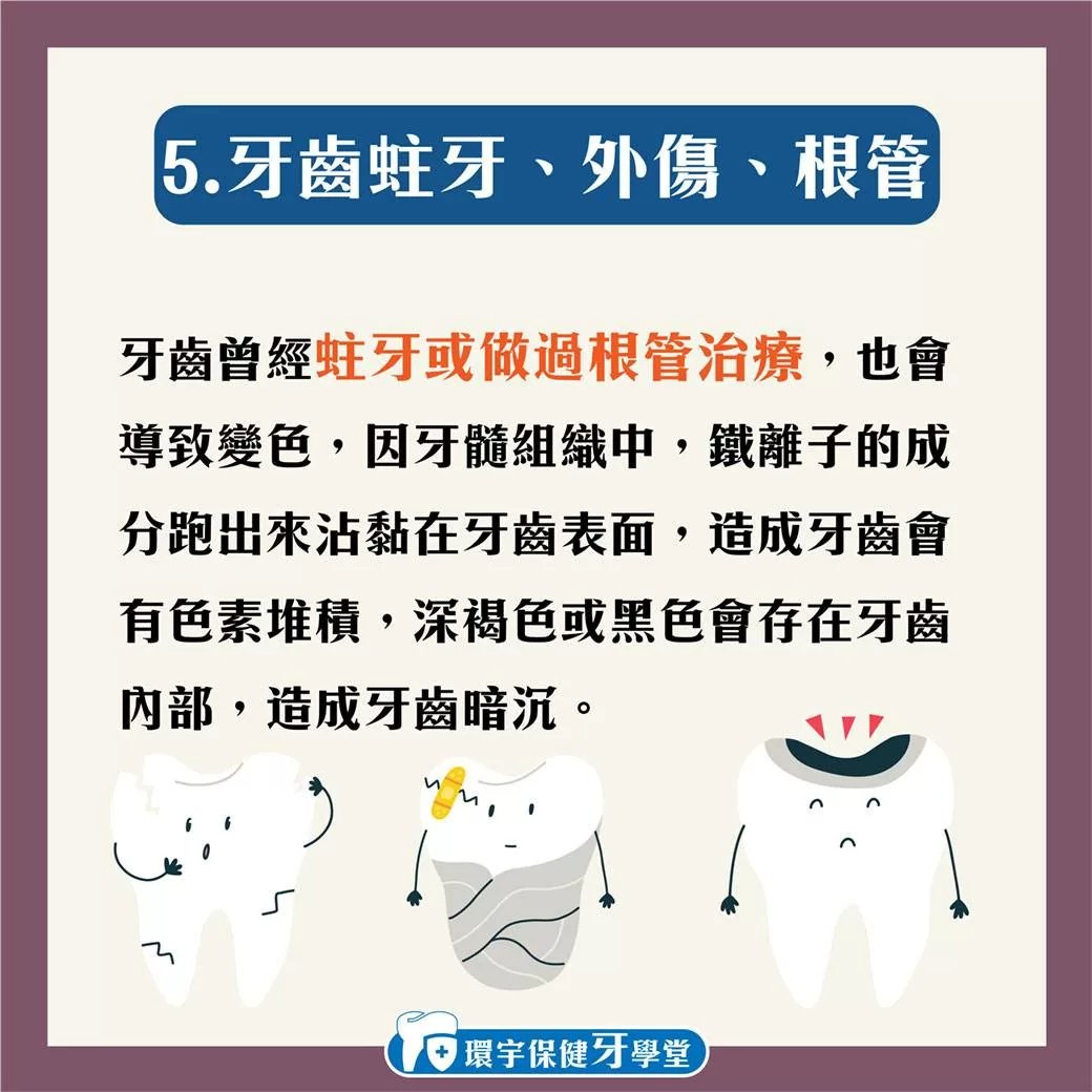 環宇保健牙學堂 - 為甚麼我的牙齒黃黃的？